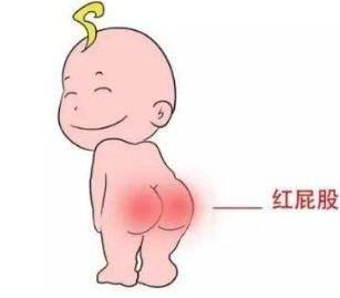 [你的育儿经]宝宝红屁股真讨厌，科学预防是关键！