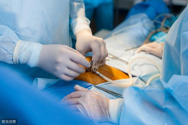 「超级宝妈」剖腹产，我经历了啥？