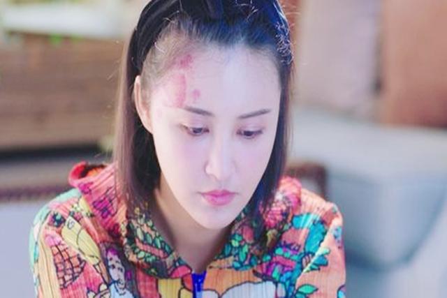 你的育儿经@胎记是如何形成的?除了遗传,孕妈三种坏习惯,会让胎记找上宝宝