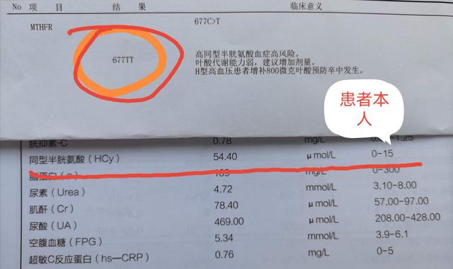 中国脑梗塞病人多，医生说：因为很多高血压病人，缺乏这种物质