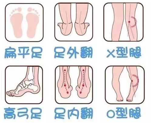 超级宝妈：8种凉鞋坑娃系数大比拼，个个都有“必杀技”，可别再给娃穿了