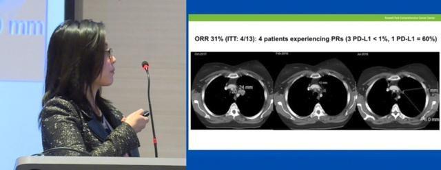 完全免费！古巴成功研发癌症疫苗，能阻止癌细胞生长，造福百姓