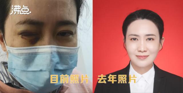 爱尔眼科回应“医生艾芬治疗后右眼近乎失明”：没有篡改调换患者病历