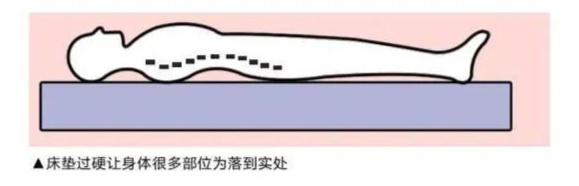 硬板床|睡硬板床硌得浑身痛，却能改善腰椎间盘突出？