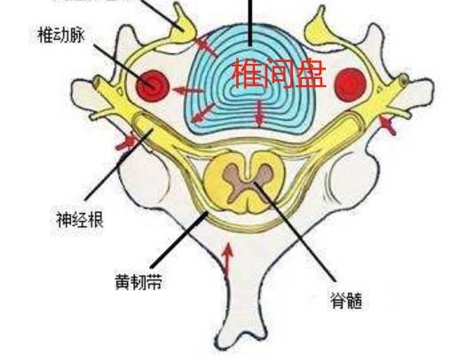 椎间孔镜|为什么颈椎病，肩膀疼痛会引起手臂麻木呢？在家要如何缓解