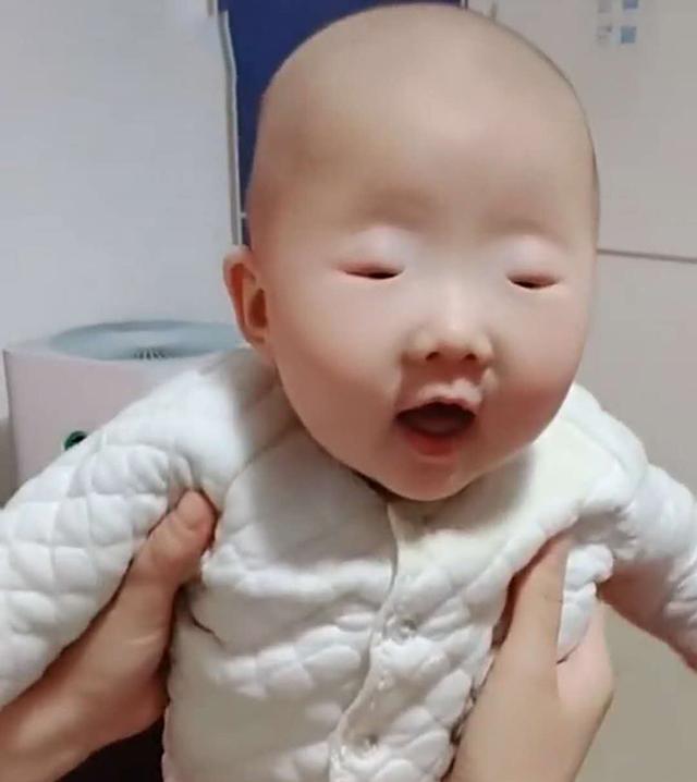 「你的育儿经」全网眼睛最小宝宝火了，眼珠只有“绿豆”般大小，李荣浩甘拜下风