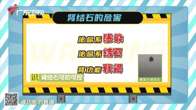 3个饮食方法，1个排石体位，教你轻松预防肾结石