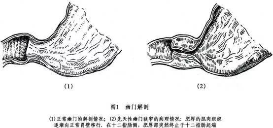 超级宝妈：儿科医生手记：三个月大的宝宝，因为异常吐奶差点丢了命