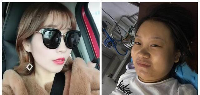 超级宝妈▲生娃有多“伤身”？看完这位双胞胎妈妈生娃前后对比照，直喊可怕