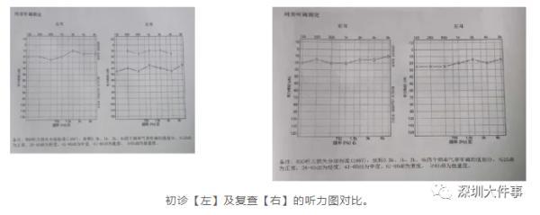 鼓膜|辅导作业太生气，父亲一怒之下……结果出事了