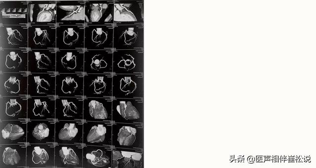 心电图|得了心脏病哪些检查最准确？这份“心脏检查指南”请收好！