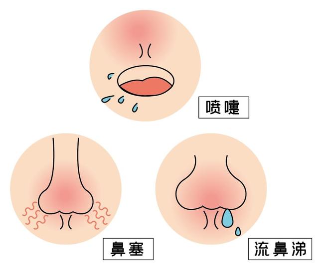 过敏|ta来了，ta来了，ta跟着花粉、树絮一道来了