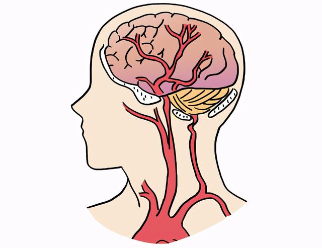 脑供血不足是怎么回事？