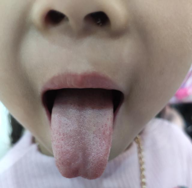 [你的育儿经]你的脾胃健康吗？