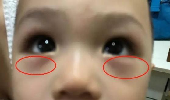 超级宝妈|儿科主任：娃有5种现象，说明孩子养成“病秧子”了，别不在意