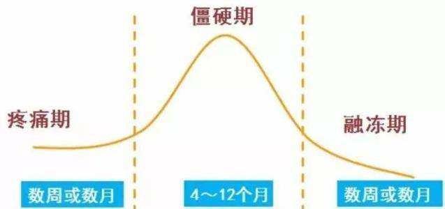 肩周炎|五十肩、肩周炎、冻结肩：还有很多，你不知道的事...