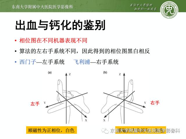 SWI的成像原理及相关病例随访