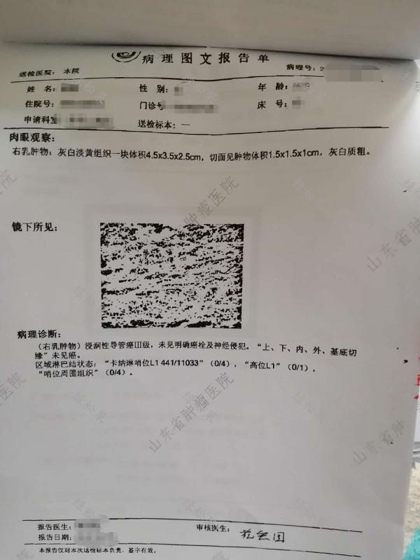 2019年4月11日偶然间摸到胸部上方有一个肿块,4月13日去医院做的彩超