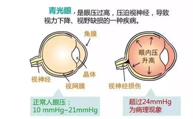 眼睛|「双语」健康用眼，你做到了吗？