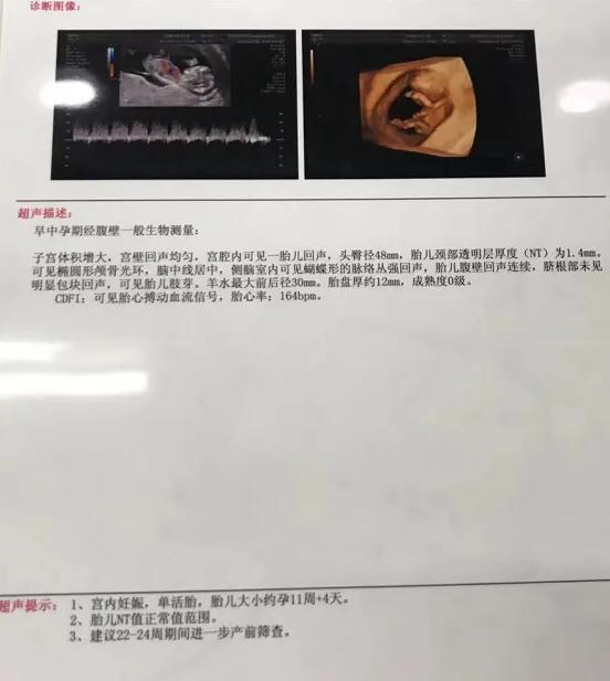 超级宝妈|高龄的我备孕二胎失败，海南慈铭三代试管一次怀上宝宝