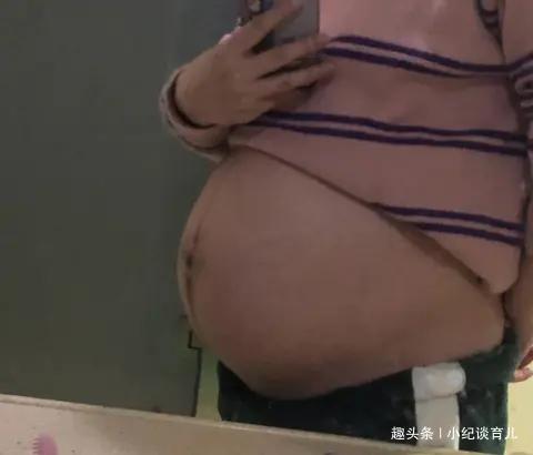 超级宝妈|早孕一路绿灯,为何还会胎停育”胎儿到底有多脆弱