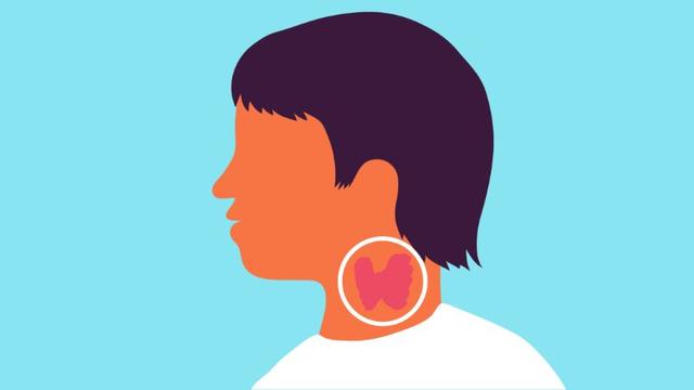 干货！超声发现甲状腺结节为4a类，是观察还是手术？