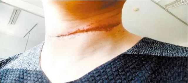 你的育儿经▲因为放风筝夫妻进了ICU