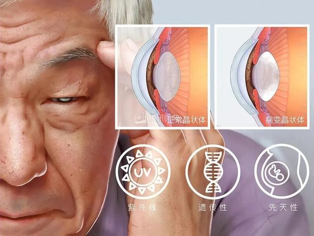 晶状体|别乱按！一女子按摩后，恶心呕吐紧急就医！这动作太危险