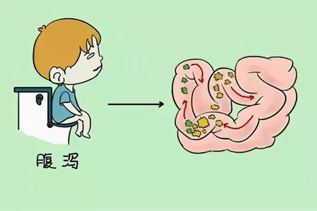 鸭脖子“立功”！咸宁女子误吞鸭骨后肠梗阻，医生术中意外发现结肠癌