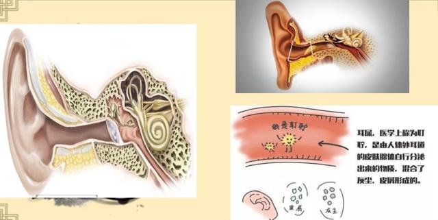耵聍|科普丨小耳洞里的大秘密——耳道里的“发酵乳”
