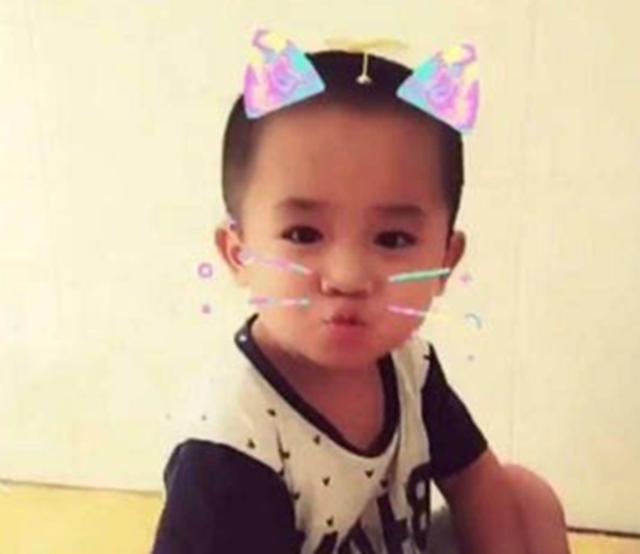 【你的育儿经】还记得四年前被妈妈用剪刀划成“花脸猫”的男婴吗？如今已成这样