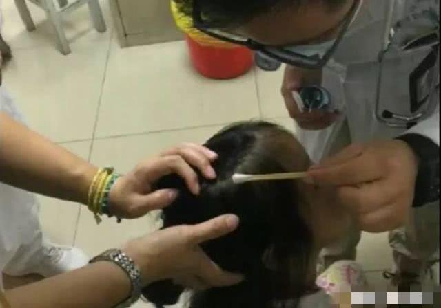 超级宝妈@这种常看到却总忽视的东西，会导致孩子脱发，宝妈们看自己娃有没