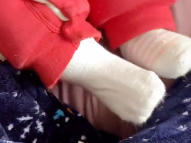 你的育儿经▲妈妈回到家，发现女儿脚丫“肿”得像馒头，脱下袜子后忍不住笑