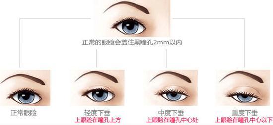 「你的育儿经」刚出生的宝宝发现一个眼大一个眼小咋回事？