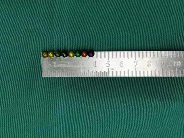 磁力珠|2岁女童腹痛呕吐，因为误吞这种“彩色糖