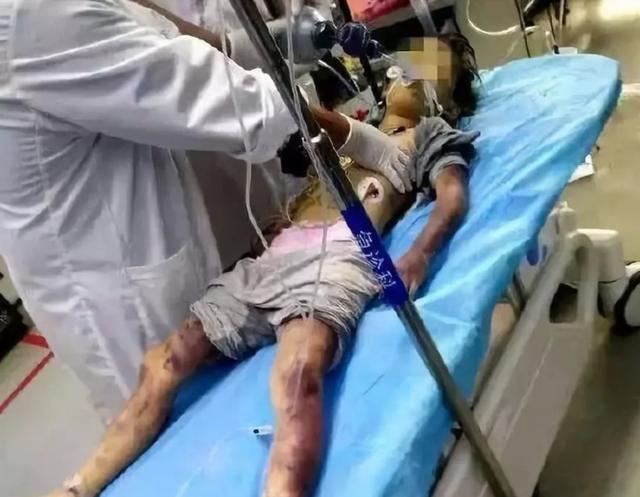 优雅的叶子■4岁女童被“网红”后妈虐待濒死：有些人，真的不配当父母