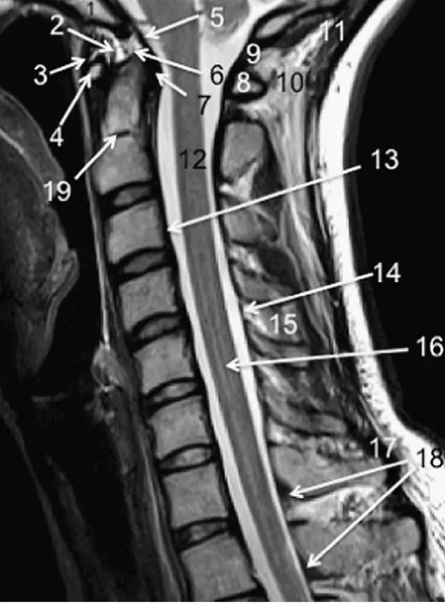 ռ׵ MRI ͼ