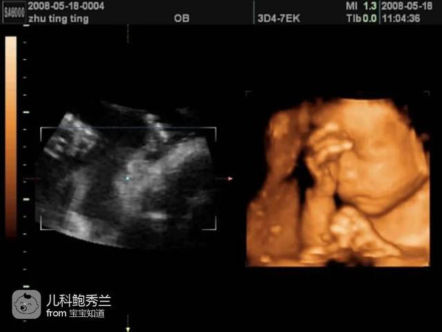 你的育儿经|孕妇做四维时胎儿为什么会捂着脸？