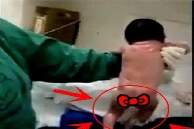 「你的育儿经」“最灵活新生儿”走红，脐带还没剪就想跑，宝妈刀口都差点笑裂了