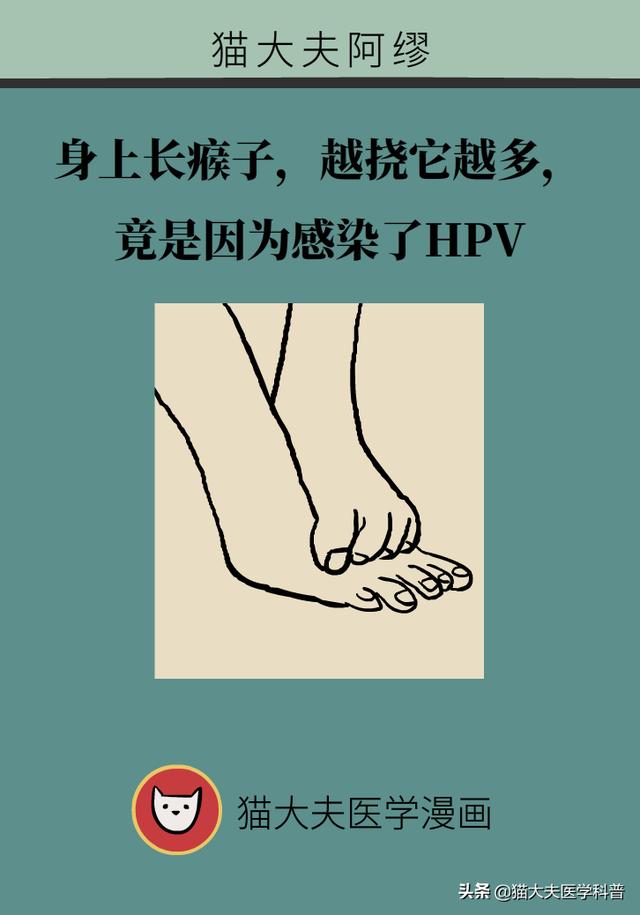 身上长瘊子，越挠它越多，竟是因为感染了HPV