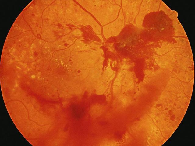 中国进入“糖朝盛世”，作为糖民，要特别警惕“糖网”的出现