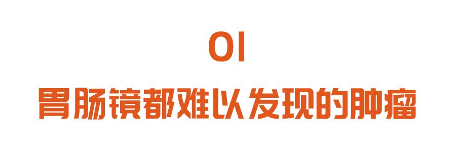 胃肠|这种长在胃肠的肿瘤，胃肠镜都难发现！五大症状，中一条都要当心