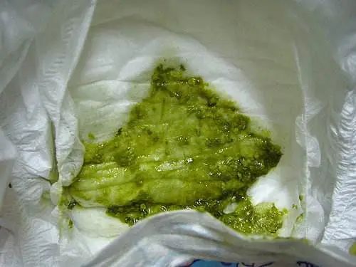 「暖先生格调」宝宝拉绿便就是奶粉的“锅”？饥饿、辅食......这些都可能，附图干货拿去！