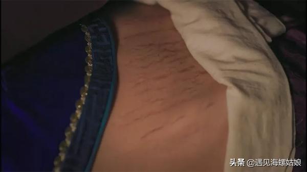 我的天使|还有多少准妈妈不知道：妊娠纹是可以预防的