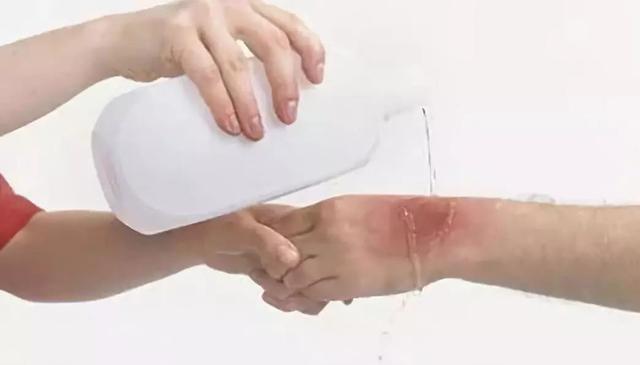 你的育儿经■孩子被烫伤后，应该先脱衣服吗？这个答案家长一定要提前知道