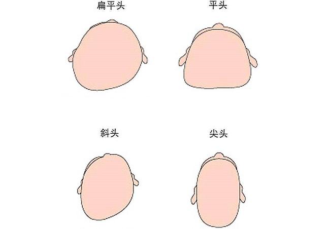 【天使宝贝】为何老一辈坚持给宝宝“睡扁头”，很影响宝宝的颜值，不信你看
