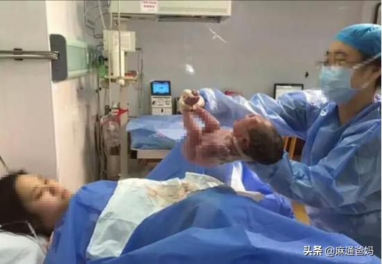 「你的育儿经」年轻产妇剖腹产生下龙凤胎，医生刚要缝合，却被产妇制止