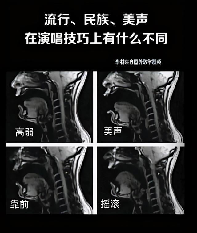 音乐人工智能的发展与思考