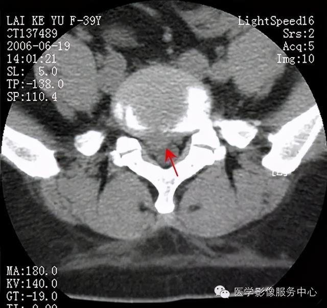 77种骨肌影像病例，助你诊断无忧