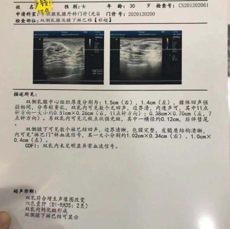 不要再被“钙化”绑架——乳腺结节患者经历